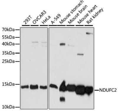 Western Blot: NDUFC2 Antibody [NBP3-02955] - Western blot analysis of extracts of various cell lines, using NDUFC2 antibody (NBP3-02955) at 1:1000 dilution. Secondary antibody: HRP Goat Anti-Rabbit IgG (H+L) at 1:10000 dilution. Lysates/proteins: 25ug per lane. Blocking buffer: 3% nonfat dry milk in TBST. Detection: ECL Basic Kit. Exposure time: 5s.